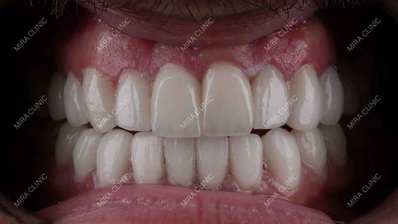 health of teeth and gums